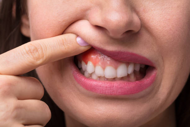 The connection between gum health and overall wellness